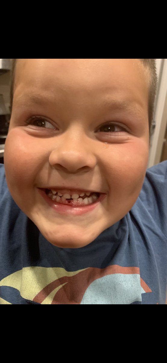 RobGalyen's tweet photo. Tears of joy!!!!!!
2ft piece of string and bathroom door is all it took
βOMG... I canβt believe Iβm not dreaming...and it didnβt even hurtβ
#1stTooth https://t.co/kNgcJ5zMpV