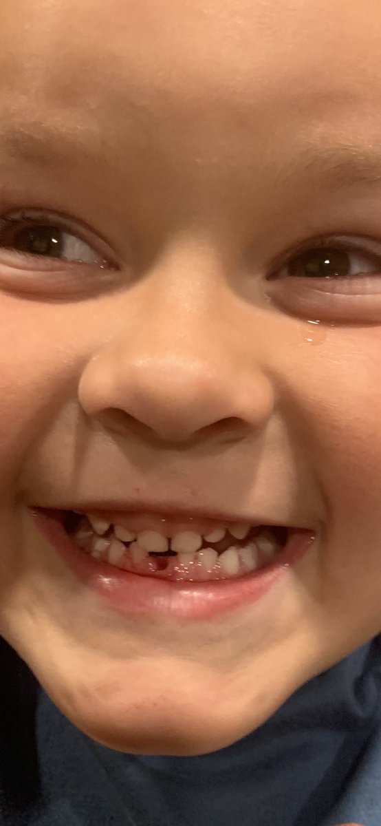 RobGalyen's tweet photo. Tears of joy!!!!!!
2ft piece of string and bathroom door is all it took
βOMG... I canβt believe Iβm not dreaming...and it didnβt even hurtβ
#1stTooth https://t.co/kNgcJ5zMpV