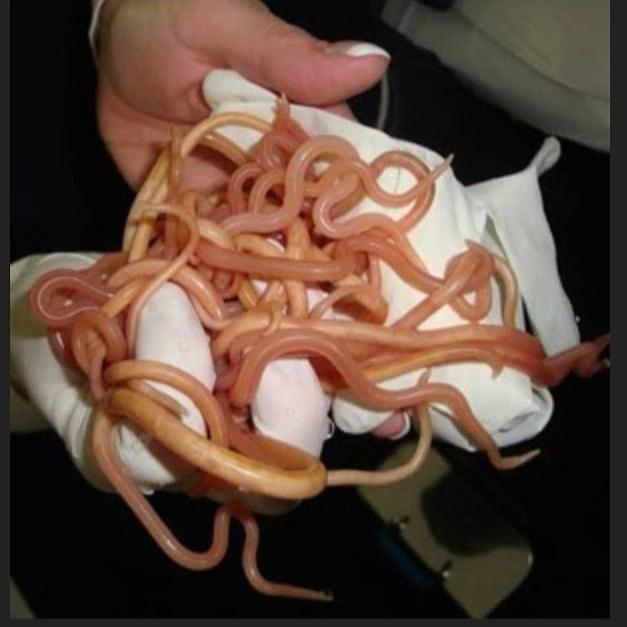 JasonFamilyMan1's tweet photo. @awilliamscomedy IF YOU EAT ANIMAL PRODUCTS YOU WILL TEST POSITIVE FOR COVID-19.....THEY DO NOT EVER VISUALLY INSPECT FOR COVID-19 CARTOONS THEY ONLY INSPECT FOR ELEVATED WHITE BLOOD CELLS WHICH YOU WILL HAVE WHEN YOU HAVE PARASITIC WORMS WHICH YOU EAT EVERY TIME YOU EAT ANIMAL PRODUCTS https://t.co/qqcTDKZQ9J
