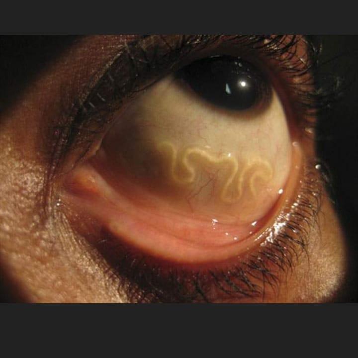 JasonFamilyMan1's tweet photo. @awilliamscomedy IF YOU EAT ANIMAL PRODUCTS YOU WILL TEST POSITIVE FOR COVID-19.....THEY DO NOT EVER VISUALLY INSPECT FOR COVID-19 CARTOONS THEY ONLY INSPECT FOR ELEVATED WHITE BLOOD CELLS WHICH YOU WILL HAVE WHEN YOU HAVE PARASITIC WORMS WHICH YOU EAT EVERY TIME YOU EAT ANIMAL PRODUCTS https://t.co/qqcTDKZQ9J
