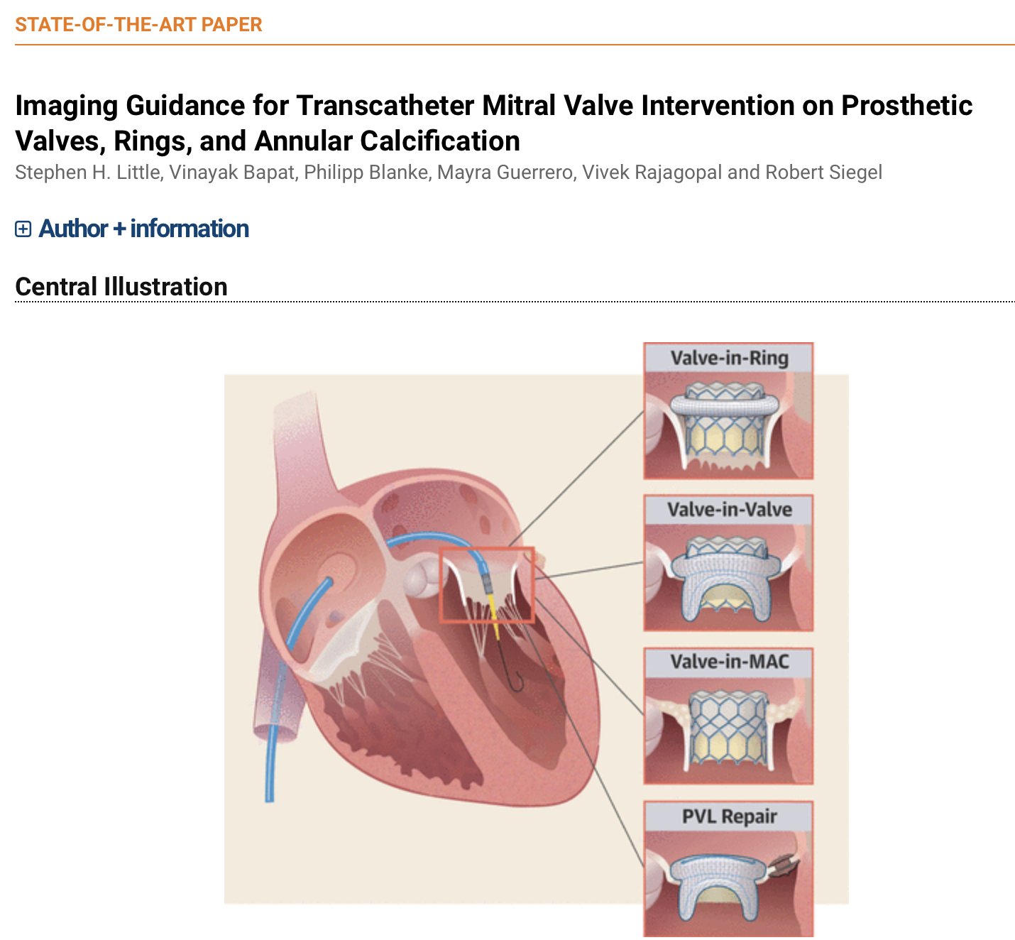Mitral Valve Dysfunction in Patients With Annular Calcification: JACC  Review Topic of the Week - ScienceDirect