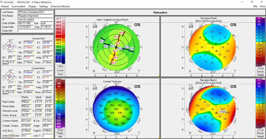 OCULUS_Inc's tweet photo. The OCULUS Pentacam® measures the front and back surface of your patients’ cornea. So, you can rest assured in your complete assessment of the most important refractive lens. 

Visit https://t.co/WicqQw571s to learn more.

#pentacam #OCULUS #OCULUSofficial https://t.co/LjampiBzmX