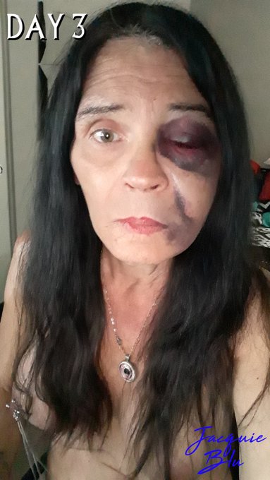 This is what I get for minding my own fucking business! I want my fucking face back! This one hurts like<a href="/tag/xbiz2019"class="tags"><span>#xbiz2019</span></a>