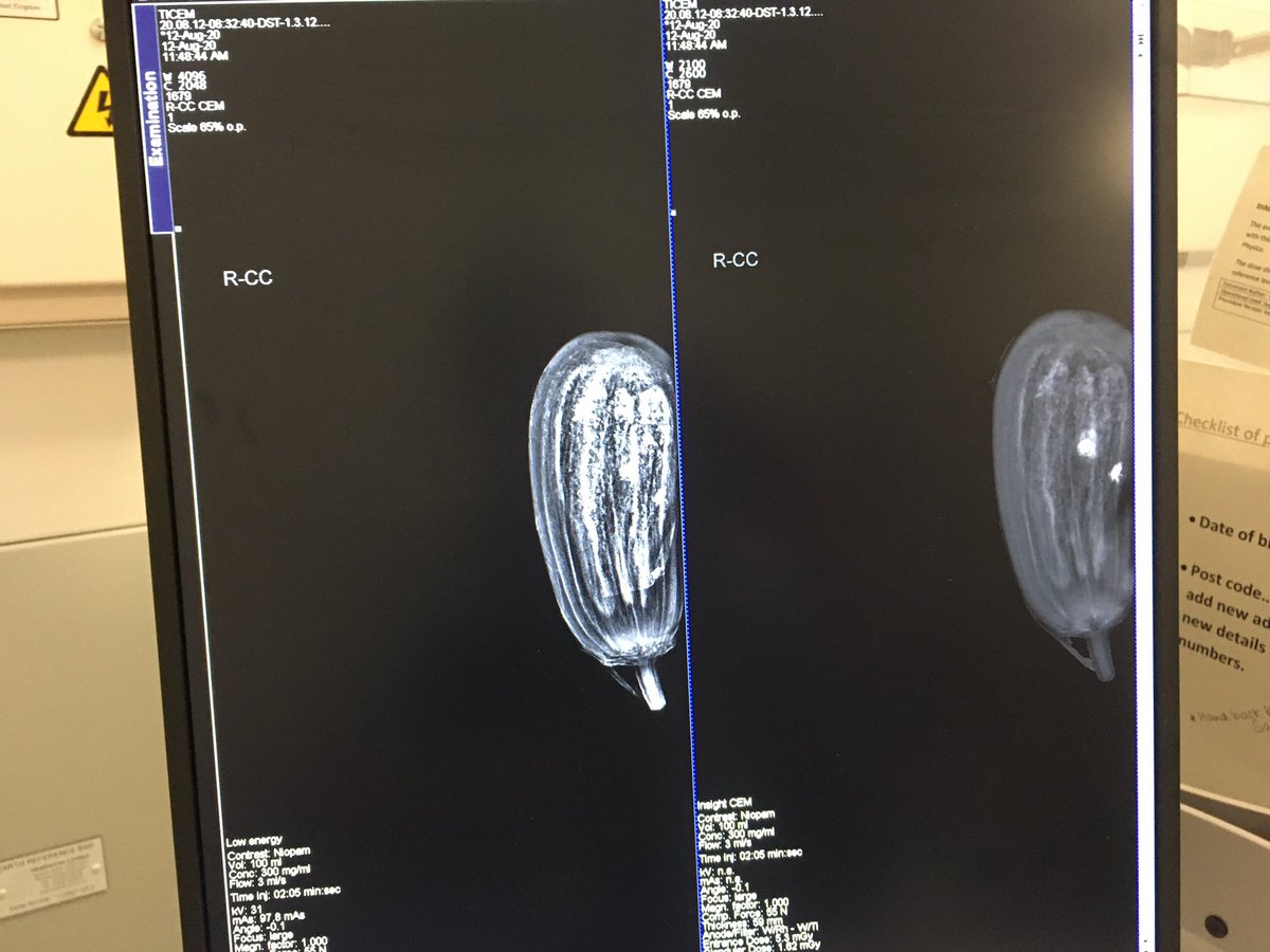 TracyBullock12's tweet image. Visited breast imaging team with our new Director if Comms. They were training on the very latest imaging equipment which will help in clinical decision-making and support patients in the care they need.  On my visit we saw just how this worked using a aubergine!