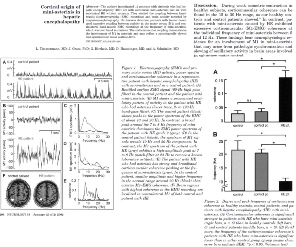 Why asterixis part 2A study using magnetoencephalography showed:There is 'excessive corticomuscular motor coherence' Diseased basal ganglia fail to select and pace the motor areasThis seems to confirm what Adams/Foley found in the brain3/4