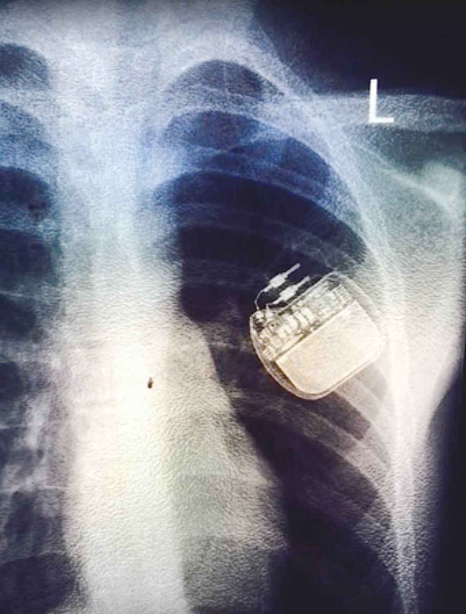 Lyn Cleaver tweet media