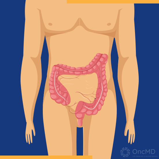 OncMD_US's tweet photo. OncMD Explains: Colorectal Cancer

https://t.co/1WVTI9Jz1D

#CancerAwareness #colorectalcancer #OncMD #OncMDExplains https://t.co/3rfjkbVAZk