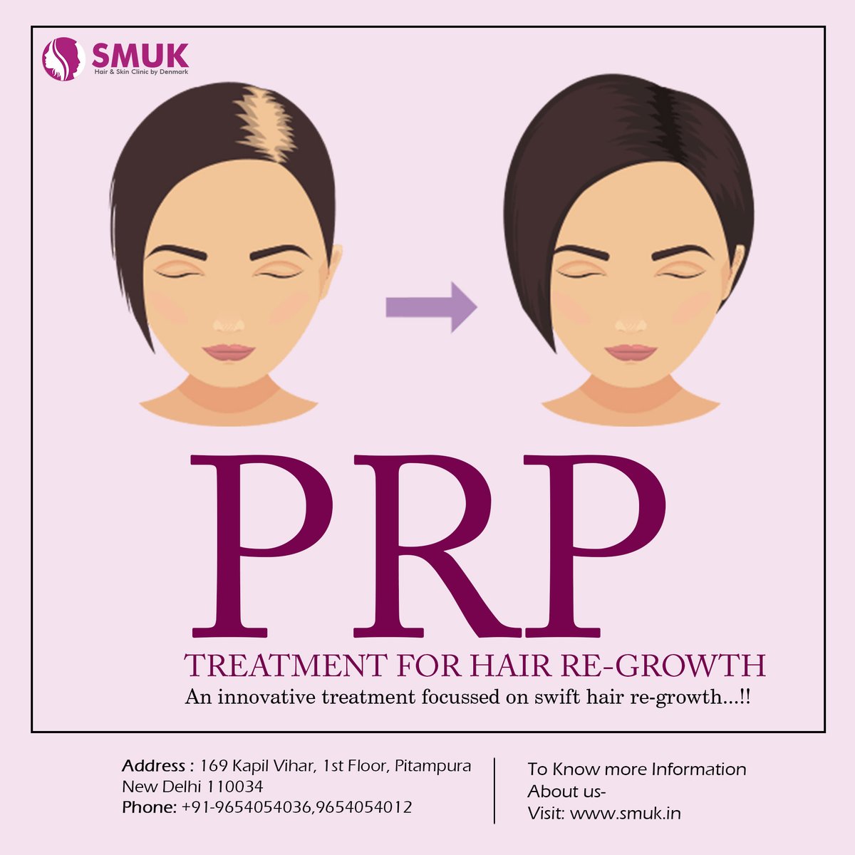 smukhairandskin's tweet photo. An innovative treatment focussed on swift hair re-growth!
👉Get to know more about SMUK on - https://t.co/FF6lUcIvLl 
👉For Consultation: ☎+91-9654054036, 9654054012
#SMUK #hairextensions #beauty #haircare #hair #hairgoals #rostyle #wecreatestyle https://t.co/xEw9SQsKUJ