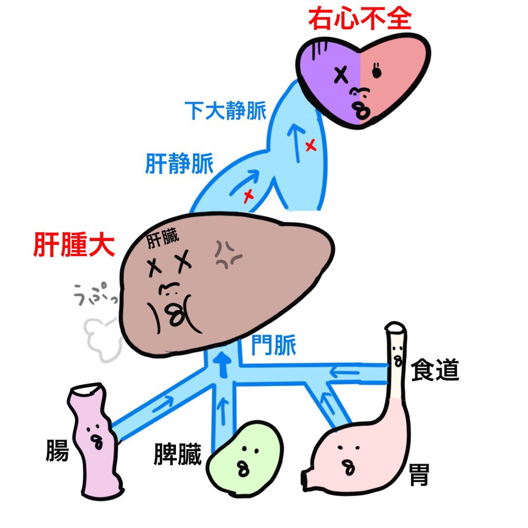 Twoucan 心不全 の注目ツイート イラスト マンガ コスプレ モデル