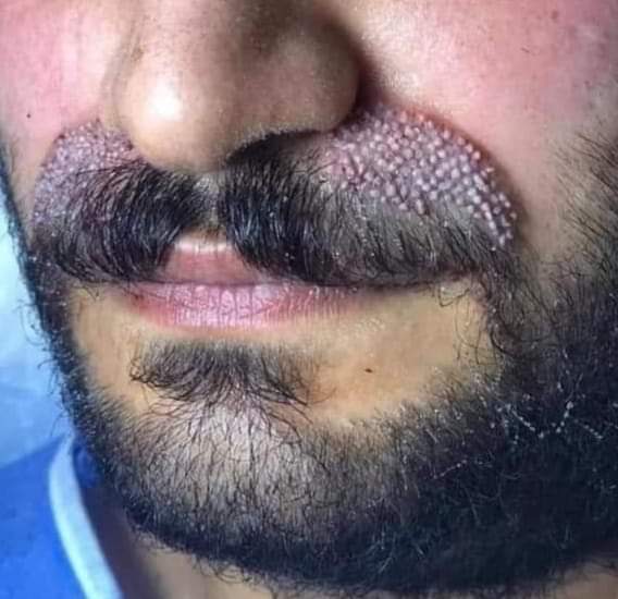 هنالك كلاب تجيد النباح عند الظهور على شاشة التلفاز 
يسمون بالسياسين