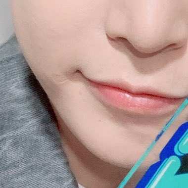 That lip scar that kept us thinking