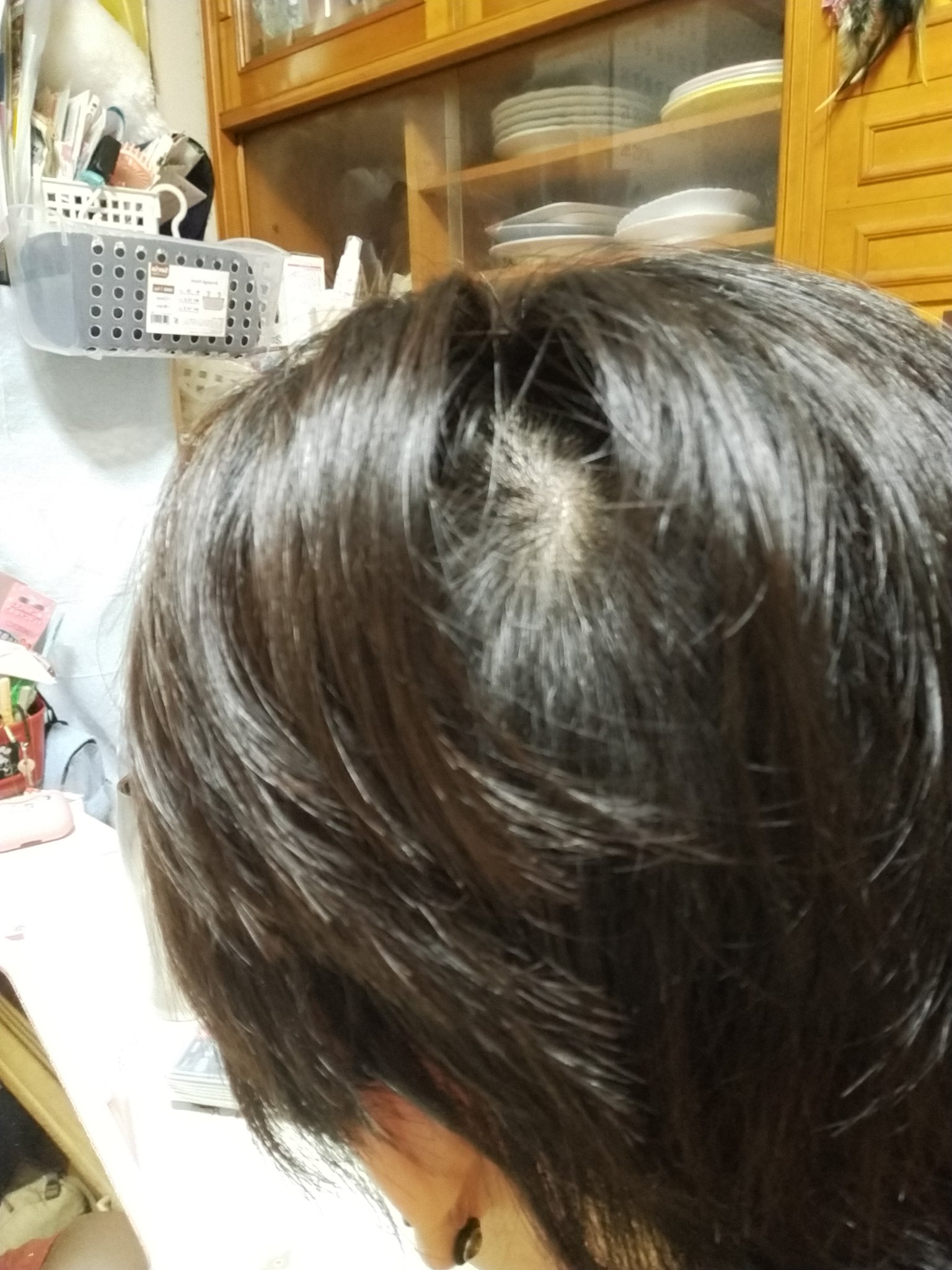 ジュリオ乗りあいちゃん Adhd野放し 普段はつむじの周りの髪の毛で薄いつむじを隠してるんやけどオープンされてる時がある それを彼はパッカーとゆう笑 そうゆう時に彼が愛ちゃん頭パッカーしてるで笑って手ぐしで隠してくれる笑 マジに