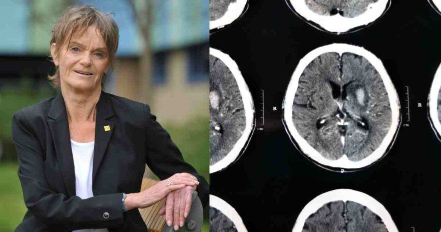 dailyhealthpost's tweet photo. Unfortunately, LIF only has a lifetime of 20 minutes.
Read the full article: Meet Dr. Su Metcalfe – The Scientist from Cambridge on the Verge of Discovering a Cure for Multiple Sclerosis
▸ https://t.co/iMMG4XAMIM
#Brain #LeukemiaInhibitoryFactor #LIF https://t.co/mukLQTNbdc