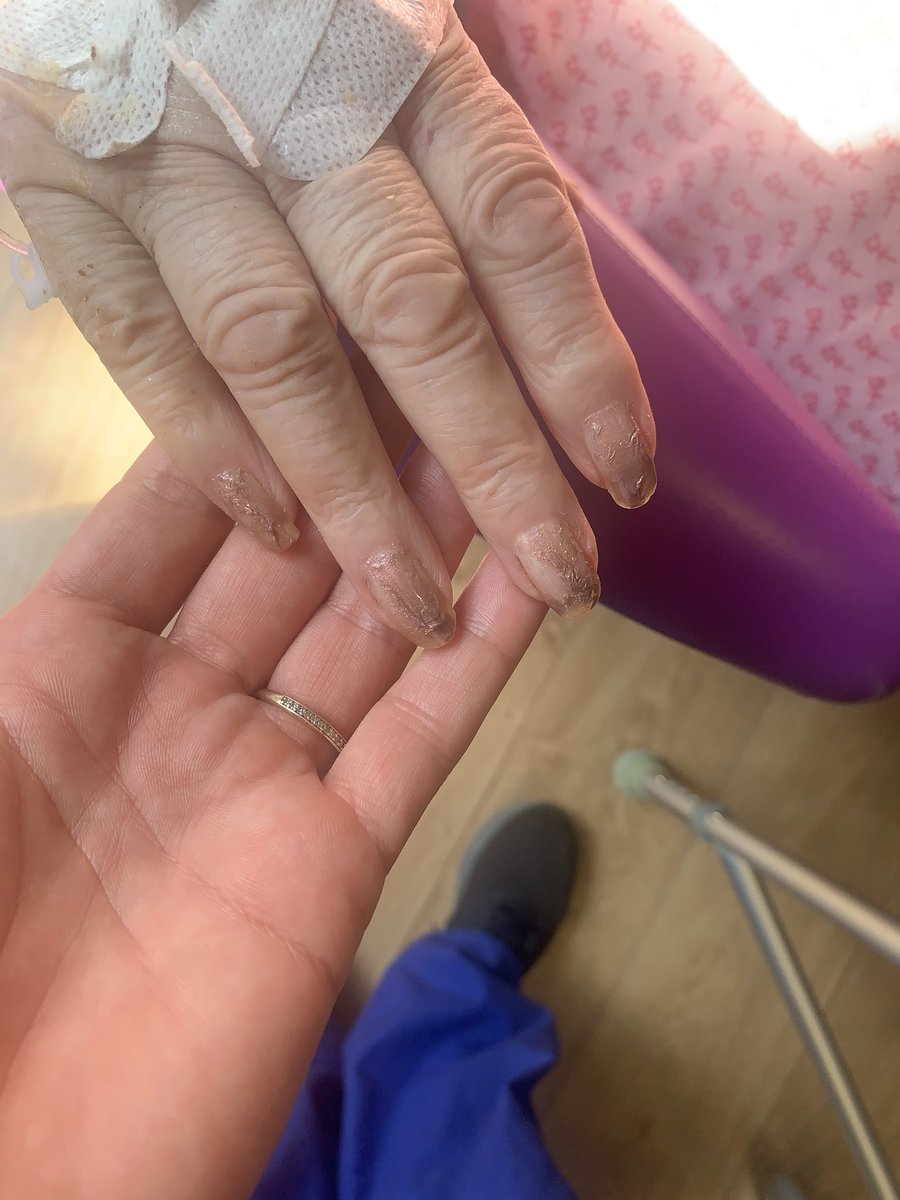 Our patients felt so Pampered today!! Sat in the sun relaxing having their nails done 💅😍 <a href="/RookwoodAWard/">RookwoodAWardCDH</a> <a href="/bradley_hb/">Helen Bradley</a> <a href="/rachel_sansbury/">Rachel Sansbury</a>