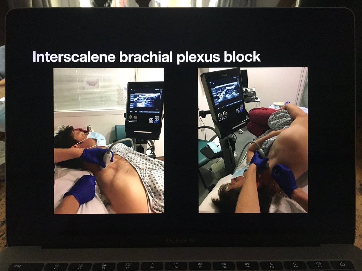 Matt Higham tweet media