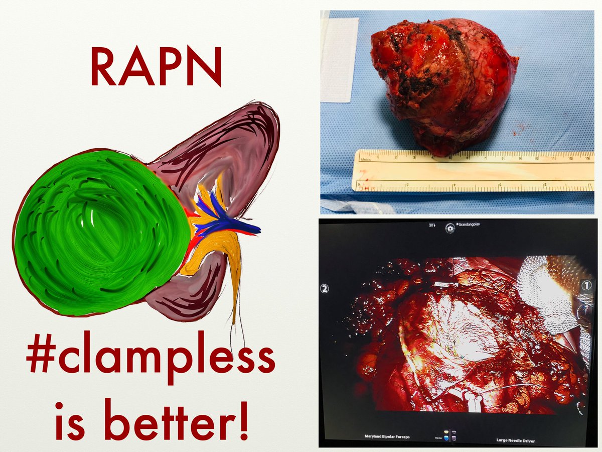 fabriziodalmoro's tweet photo. #clampless. @uniud https://t.co/5rxRMy6MG2