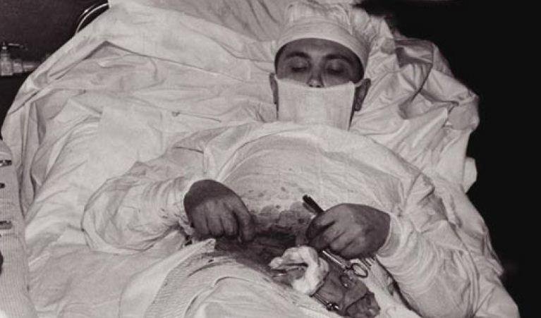 (1/10) THREADThis is a photo of Leonid Ivanovich Rogozov, who successfully removing his own appendix in 1961. Rogozov knew he was in trouble when he began experiencing intense pain in the lower right quadrant of his abdomen. It could only be one thing: appendicitis.