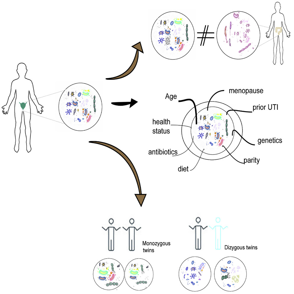 cellhostmicrobe's tweet photo. Urinary Tract #Microbiome in Older Women: Using @TwinsUKres @DrClaireSteves &amp;Co explore #microbes in urine of community-dwelling women. They ID common core #microbes &amp; reveal age, genetics, &amp; other host factors contribute to urinary microbial variation https://t.co/uqTK91bMTI https://t.co/br1xLf2plI