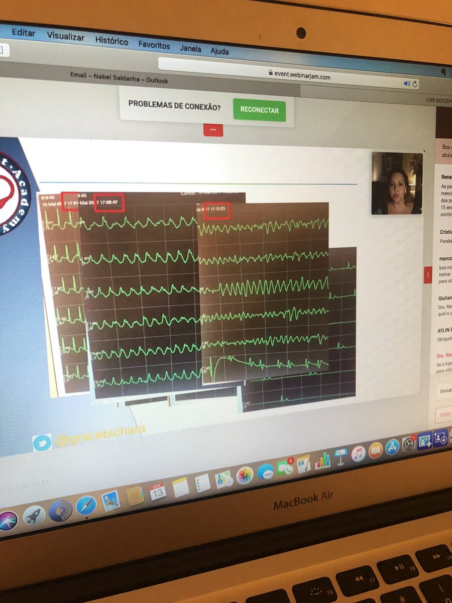 Nabel (@nabelsc) on Twitter photo Study Night! An exciting webinar on Pediatric Cardiac Intensive Care from Departamento de Cardiopatias Congênitas e Cardiologia Pediátrica. Another great lecture by Dr. <a href="/gracebichara/">Grace van Leeuwen</a> ! Study Night! An exciting webinar on Pediatric Cardiac Intensive Care from Departamento de Cardiopatias Congênitas e Cardiologia Pediátrica. Another great lecture by Dr. <a href="/gracebichara/">Grace van Leeuwen</a> !