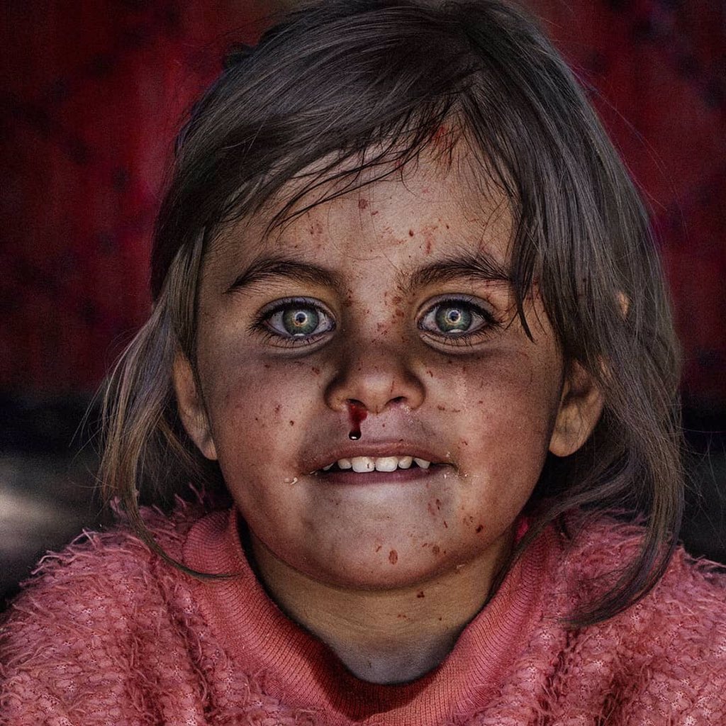 It's the "smile of fear", as described by its photographer @blackedition001 Taken 7 minutes after the #Beirut blast, this image illustrates the terror, anger, and heartache felt by every #Lebanese 💔🇱🇧 #WeAreLebanon