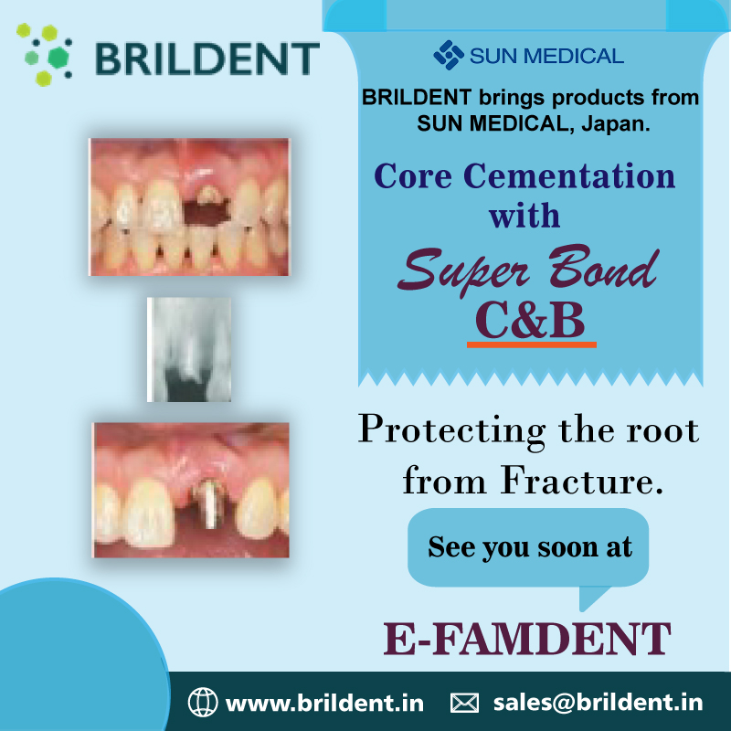 dentaproducts's tweet photo. Core Cementation with "Superbond C&amp;B"

Protecting the root from Fracture.

#Corecementaton #dentalcause #Dentists #dentistry #Superbond #Brildent #Dentalproducts #Exhibition #eexpo #Eeconference #SunMedical #japan https://t.co/A8yXHh0soH