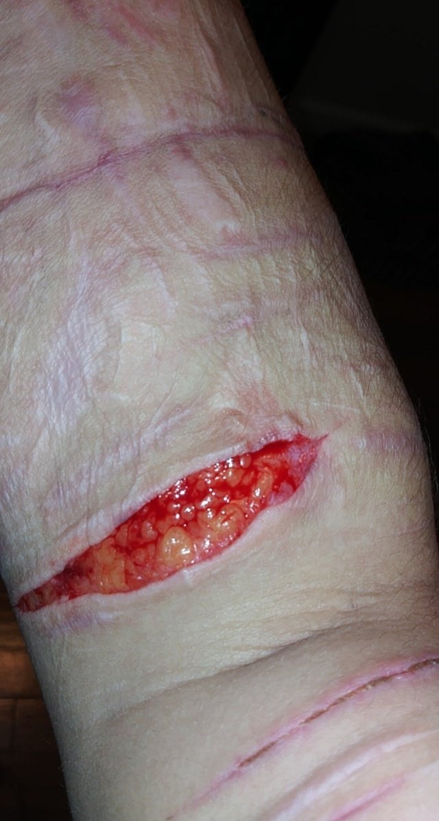 Babi_gore's tweet photo. #proselfharm #selfharmtwt https://t.co/FYipxm01rn