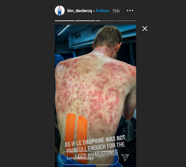 roadcc's tweet image. Tim Declercq "healing up nicely" after revealing shocking bruises caused by hailstones at the Critérium du Dauphiné: yesterday's stage was described as "total chaos and mayhem" as a vicious storm battered the peloton. road.cc/276447 #cycling