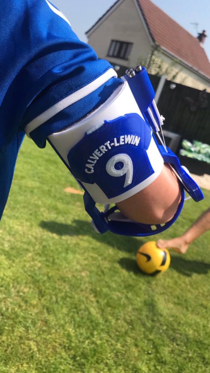 CalvertLewin14's tweet photo. A big shoutout to Kobi 🙌🙌🙌 Born missing his right forearm and hand but now has an @everton 3D printed arm and looks sharp in the new kit 👊💙 https://t.co/wFfJUjQeMf