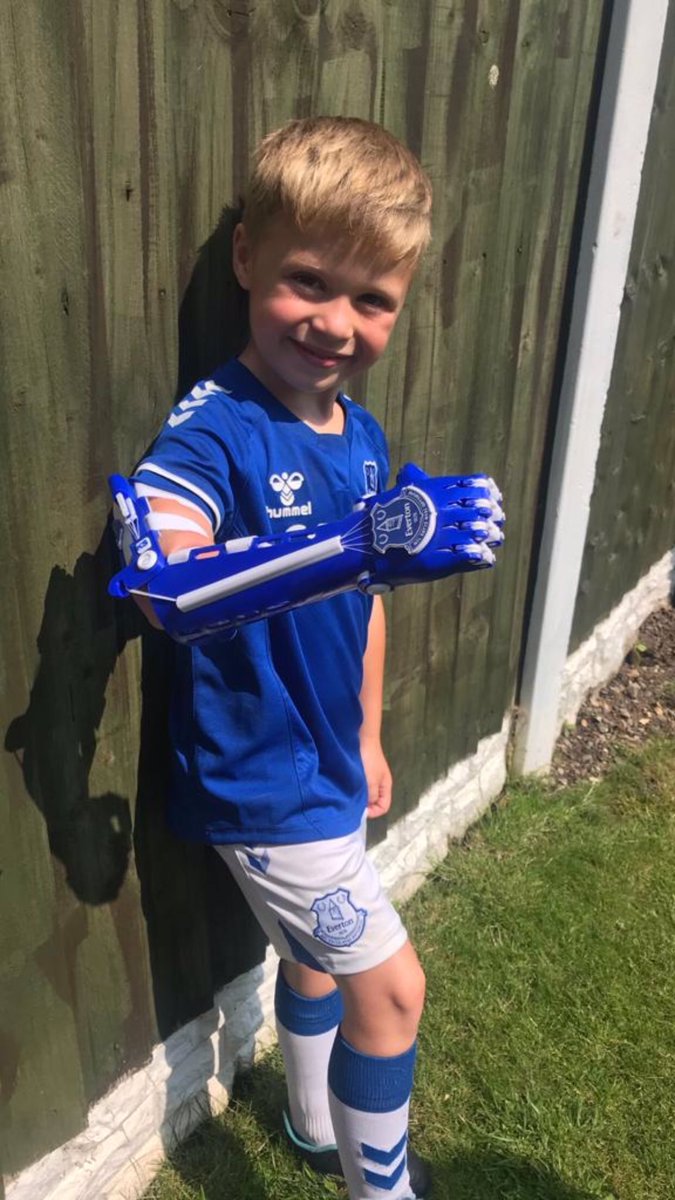 CalvertLewin14's tweet photo. A big shoutout to Kobi 🙌🙌🙌 Born missing his right forearm and hand but now has an @everton 3D printed arm and looks sharp in the new kit 👊💙 https://t.co/wFfJUjQeMf