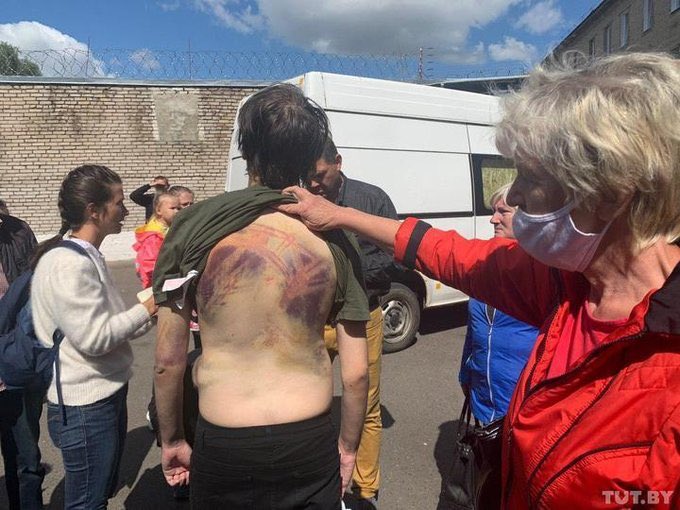 StalinGulag's tweet photo. Могилёв. Освобождённый задержанный. Словно он был не в отделе милиции, а в нацистком концлагере https://t.co/vwYUjpOsA0