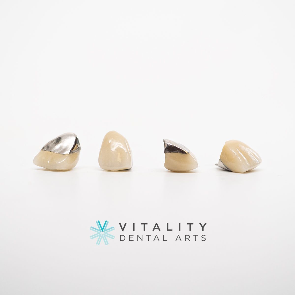 VitalityDigital's tweet photo. Yes, surprisingly PFM crowns still come through the lab every day 😯  These metal occlusal, porcelain fused to metal crowns are going to help a patient with their tight, strong bite and also mask out their dark prep stumps.  

#dentallab #dentistry #vitalitydentalarts #crowns https://t.co/94UkEXdFk3