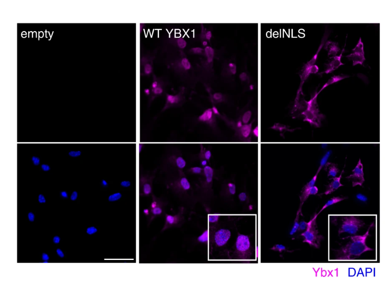 NeuralCell's tweet photo. Published in @NatureComms | In #NeuralProgenitorCells, Ybx1 controlled self-renewal and neuronal differentiation. @StJudeResearch
📖 Full article https://t.co/BEcOIPIbMT https://t.co/AQbVinCkK4