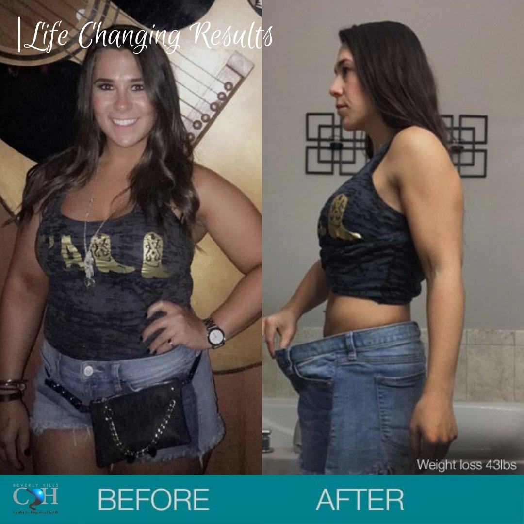 GastroDoctorLA's tweet photo. Many of our patients see the difference and #amazingresults after being treated from digestive problems. Don't hesitate to give us a call if you are experiencing any #digestiveissues. You can be next on our #beforeandafter showroom. https://t.co/u1o94IRhxN