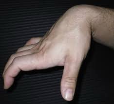 XrayProblems tweet picture