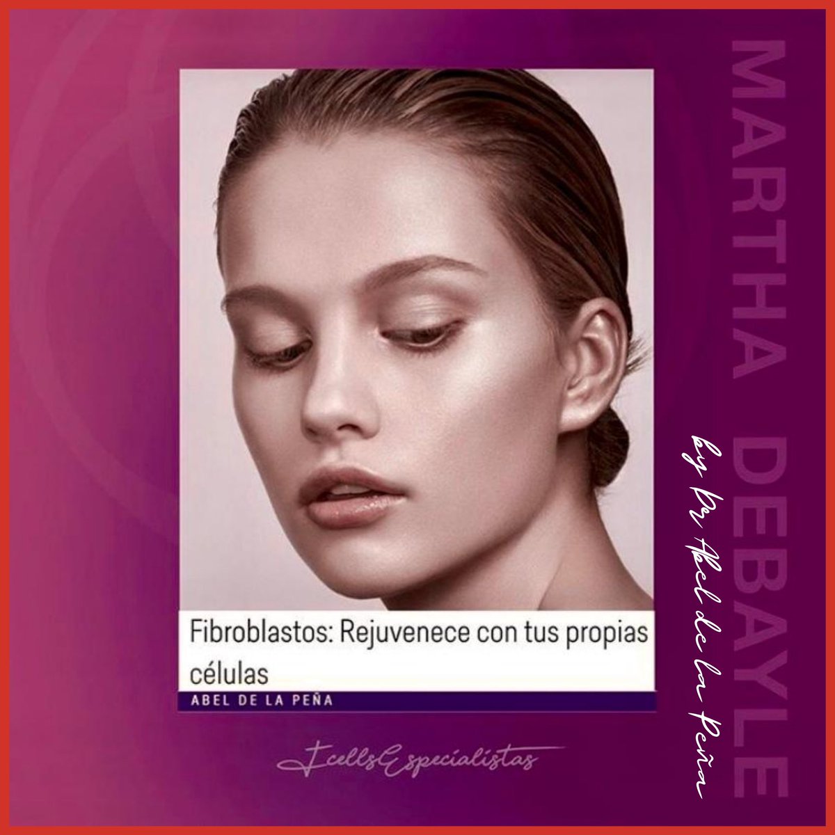 Abel_dp's tweet photo. Les comparto la plática que tuve con @marthadebayle acerca del tratamiento con fibroblastos. #pieljoven #fcells #beautylabmex https://t.co/EzdqKxGsaX
