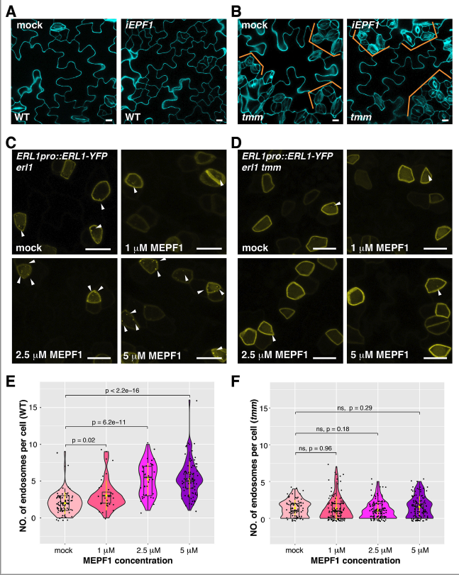 Stomata_Tweets's tweet photo. Finally in @eLife. The manifold actions of signaling peptides on subcellular dynamics of a receptor specify stomatal cell fate. Congrats, all🌱🔬! https://t.co/R7WtxXgPc4 https://t.co/qWsxVEJf8C
