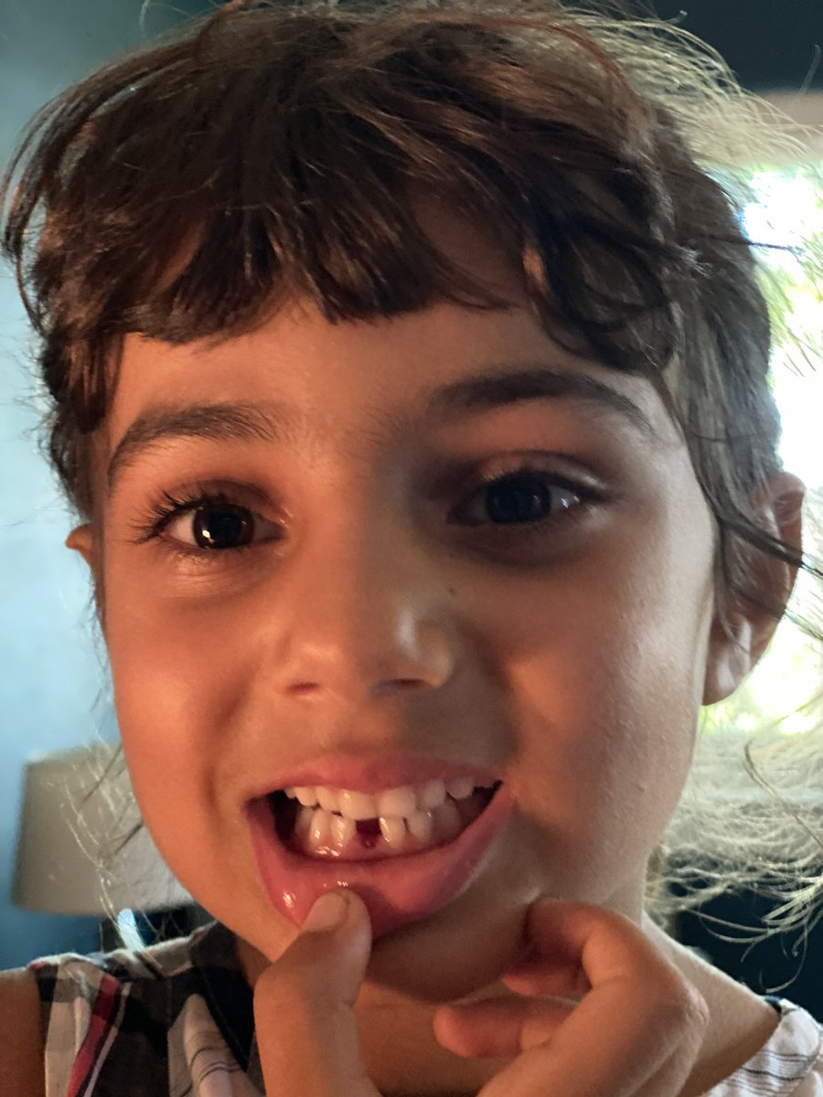 NursePapa's tweet image. My first child just lost her first tooth. #fatherhood #QuarantineLife #losttooth #toothfairy