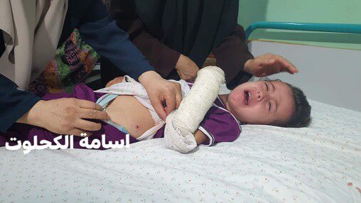 MaBuddytango's tweet photo. No hay palabras para describir tanta maldad, solo el dolor como humana, rabia e impotencia. 
Estas fotos son de los niños que fueron heridos en el bombardeo de hoy. 
Cuál ha sido su crimen? Cuál es su culpa? 😞💔
#Group4Palestine https://t.co/FtGXHxzi8F
