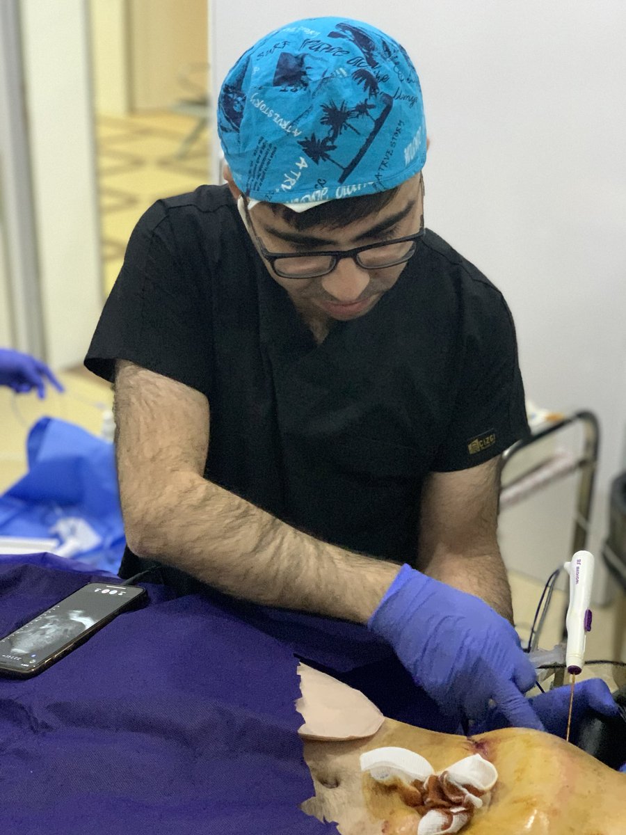 SUHAIBa2t's tweet photo. RadioFrequency  ablation: metastatic liver lesion #butterflyNetInc https://t.co/ht2S0sJq9v