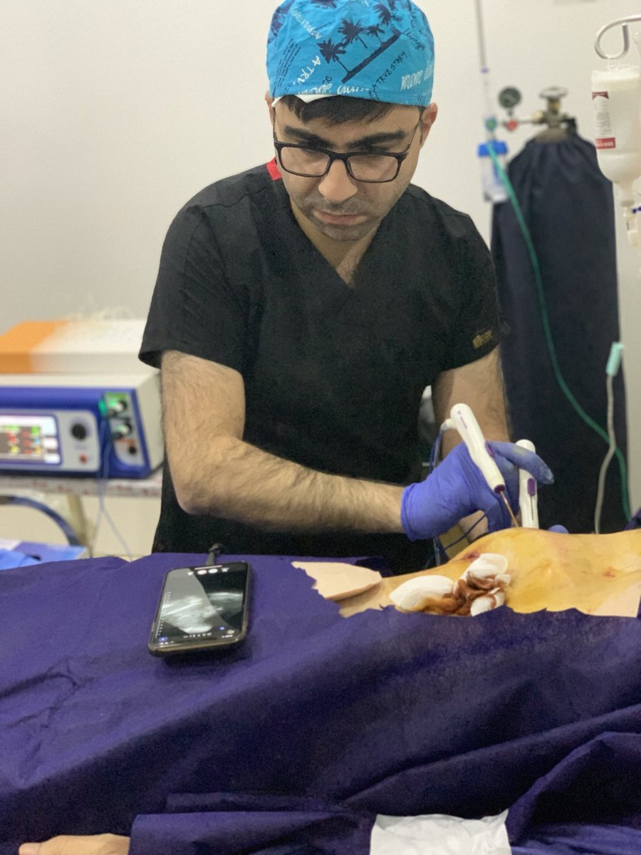SUHAIBa2t's tweet photo. RadioFrequency  ablation: metastatic liver lesion #butterflyNetInc https://t.co/ht2S0sJq9v