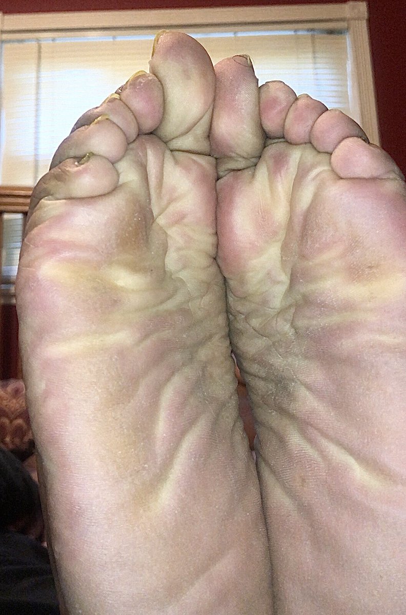 SolelyMe3's tweet photo. Pedicure needed. #Wrinkledsoles #feetfetishcommunity #meatysoles #ebonyfeetfetish #ebonysoles #widesoles #juicyfeet #feetpicsformoney  #thicksoles #footfetishgroup #footfetishnation #solelicious #solesandtoes #texanfeet #wrinklesgalore #solesmodel #juicysoles #amazingsoles #soles https://t.co/cGOEswPxUC