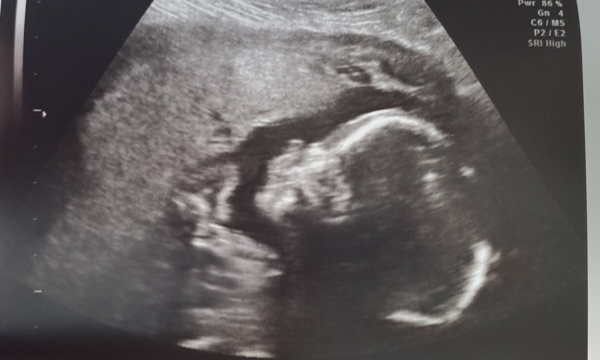 ZoeShea1997's tweet photo. He’s so prefect already 💙 https://t.co/fuhMnKSpvy