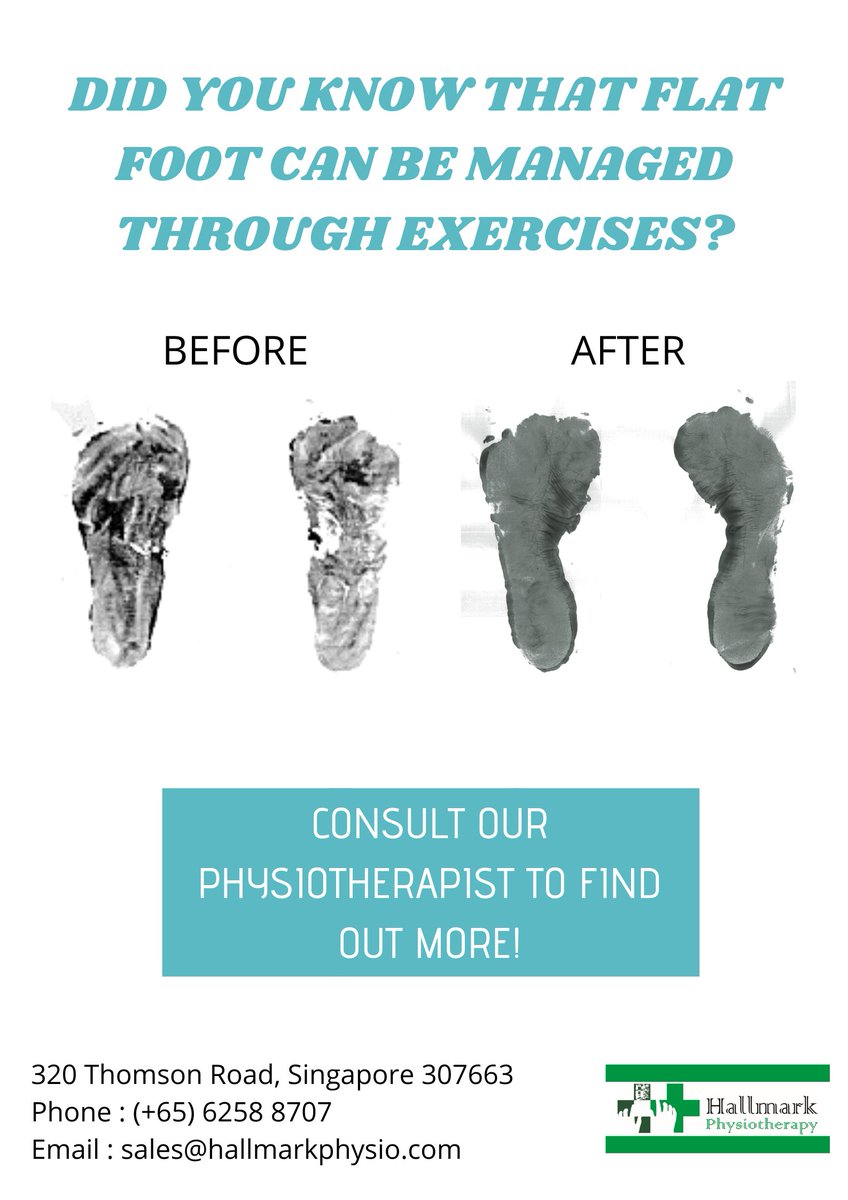 HallmarkPhysio's tweet image. Is your flat foot causing you pain/discomfort? Contact us now to manage it by just doing simple exercises!