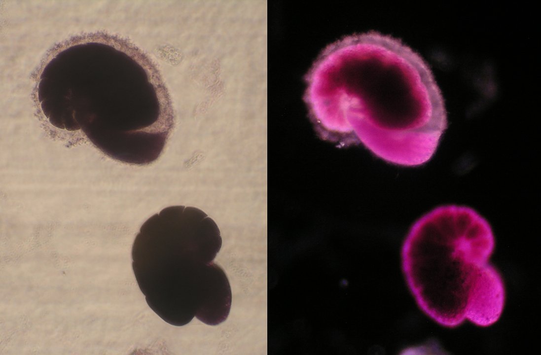 jcocardich's tweet photo. #foramfriday #forams @forhums 
Dissolving Nonionella auris from the shelf off Callao, #Peru https://t.co/qqPyKZBEHO