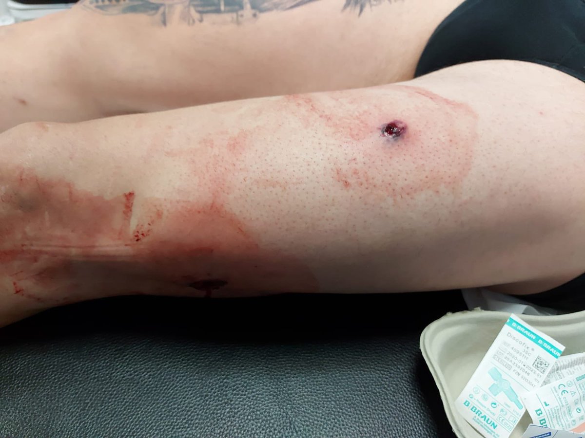 jucilLasPalmas's tweet photo. 🚨🚨🚨🚨🚨🚨
Todo el apoyo 💯x💯 de @jucilnacional para el compañero tiroteado 🔫 esta madrugada cumpliendo con su deber
Desearle una pronta recuperación 🏨 y felicitarle por su valor🏅
Usemos las medidas de protección 

#NoSomosUnGastoSuperfluo
#ProhibidoRendirse
#EquiparacionYa https://t.co/mUrcWQb166
