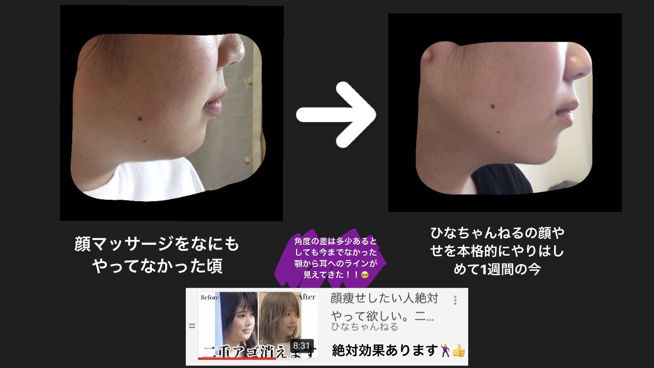 ミク on X: ひなちゃんねるのこの動画のおかげで顔やせしました😌！まだまだだからこの動画のやつずっと続ける！  (ちなみにこの動画の内容を朝夜1日2回、1週間やった結果です) t.co06smoRw1x4  X
