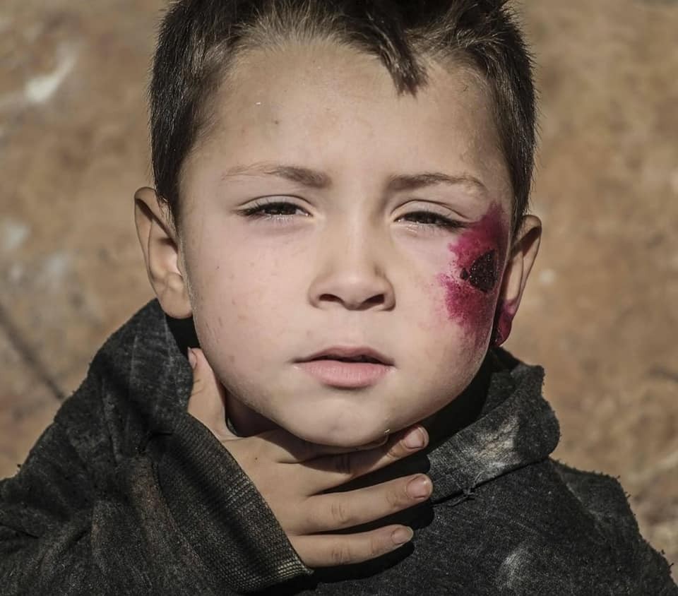 In IDP camps in #Syria, the lack of toilet facilities &amp; sanitary systems are creating contaminated water pools &amp; an environment prone to the spread of epidemics, such as leishmaniasis. 

Help us build sanitary facilities &amp;sanitary systems to make life their lives less burdensome.