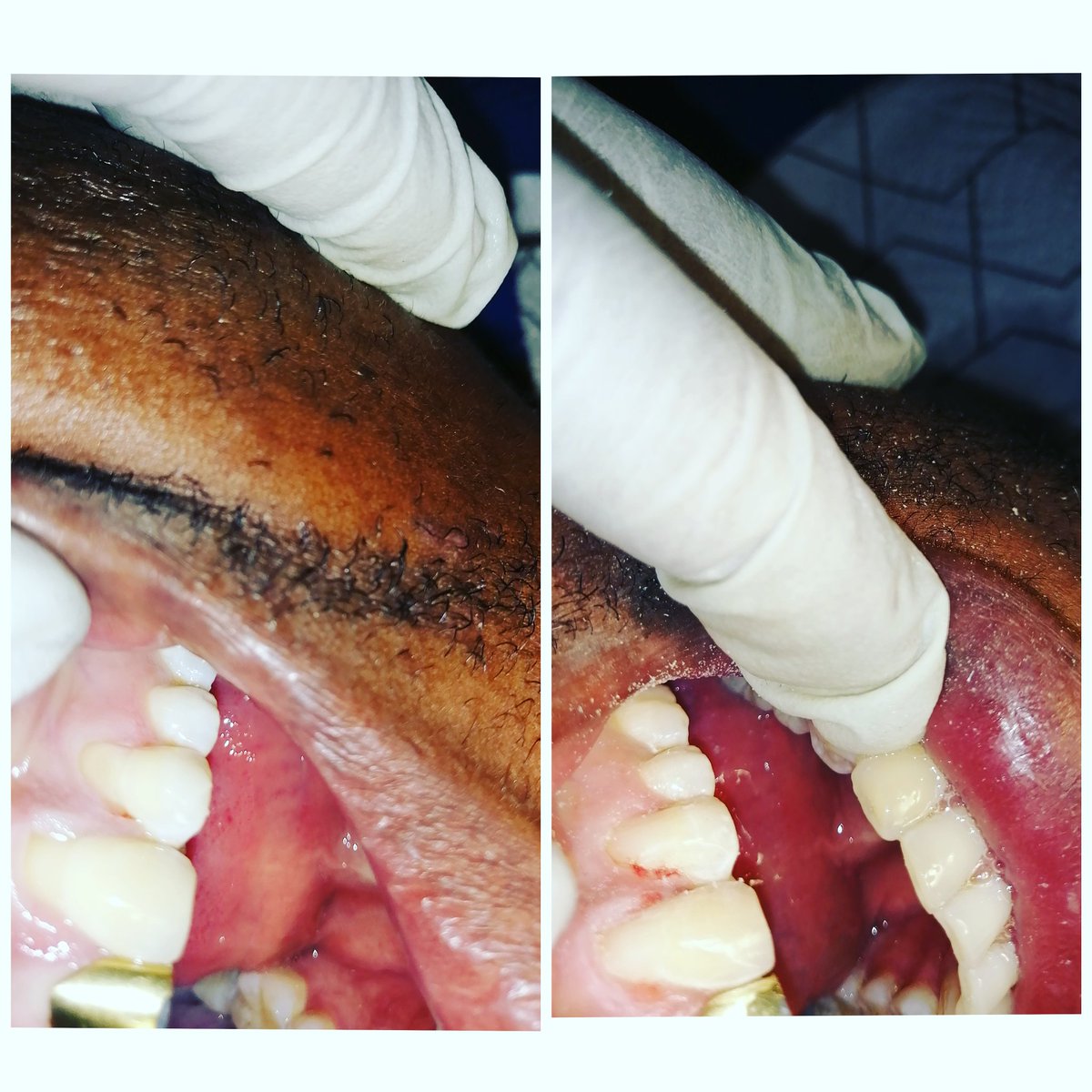 PrimesmileD's tweet photo. Brushing your teeth too hard can cause sensitivity in future. Visit a dentist or oral hygienist for instructions on how to brush.... https://t.co/6iRjVmq8CQ