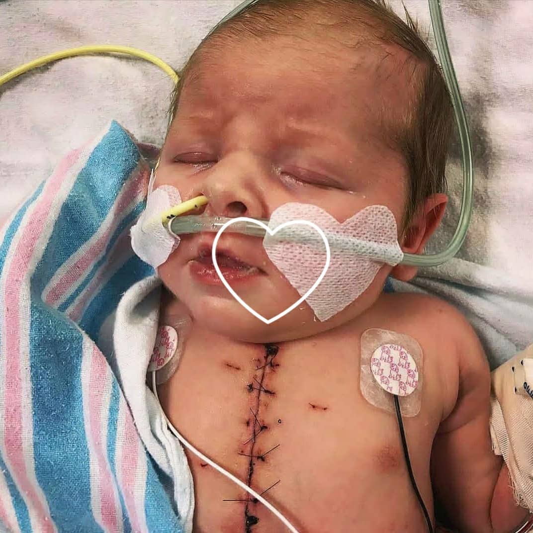 Inspiring story of Little Zola born with hypoplastic left heart syndrome, a congenital heart defect in which the left side of the heart is critically underdeveloped.After a long open heart surgery, this warrior is off from the breathing tube & on the road to full recovery.