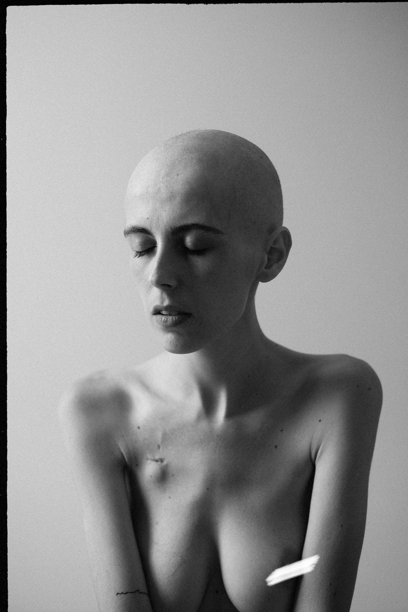 Mi mejor cura es la fotografía.